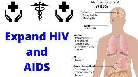 expand the term aids and hiv
